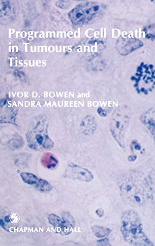 

general-books/general/programmed-cell-death-in-tumours-and-tissues--9780412279706