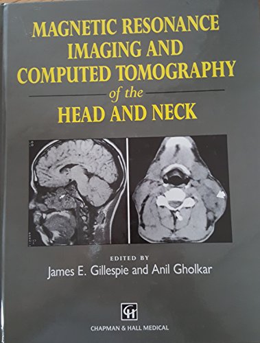 

general-books/general/magnetic-resonance-imaging-and-computed-tomography-of-the-head-and-neck--9780412452000