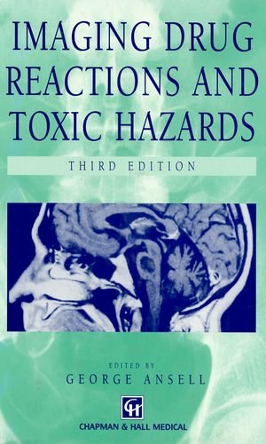 

general-books/general/imaging-drug-reactions-and-toxic-hazards--9780412555909