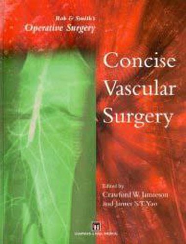 

surgical-sciences/cardiac-surgery/rob-smith-s-operative-surgery-concise-vascular-surgery--9780412824500