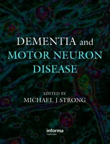 

general-books/general/dementia-and-motor-neuron-disease--9780415391665