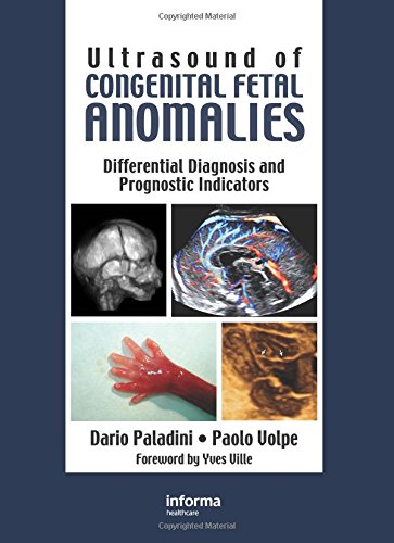 

general-books/general/-ex-ultrasound-of-congenital-fetal-anomalies-differential-diagnosis-and-prognostic-indicators-1-ed--9780415414449