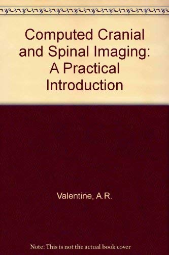 

general-books/general/computed-cranial-and-spinal-imaging-a-practical-introduction--9780433000013