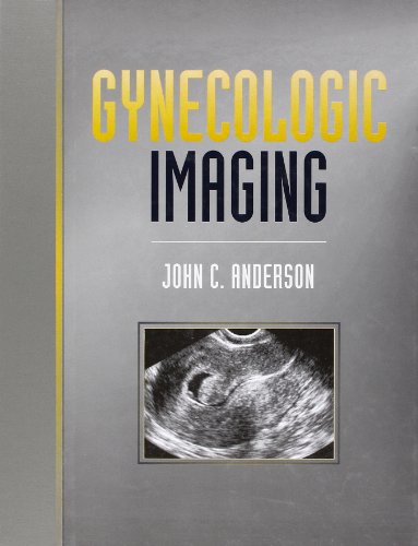 

exclusive-publishers/elsevier/gynecologic-imaging--9780443052392