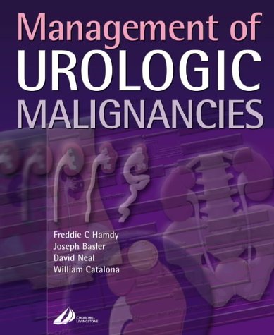 

exclusive-publishers/elsevier/management-of-urologic-malignancies--9780443054785