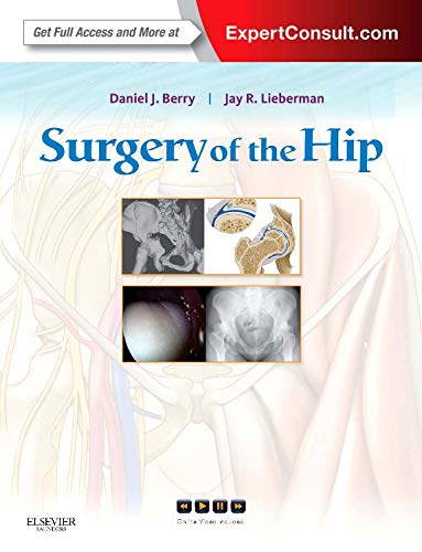 

mbbs/4-year/surgery-of-the-hip-expert-consult---online-and-print-1e-9780443069918