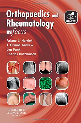 

general-books/general/orthopaedics-and-rheumatology-in-focus-1e--9780443100864