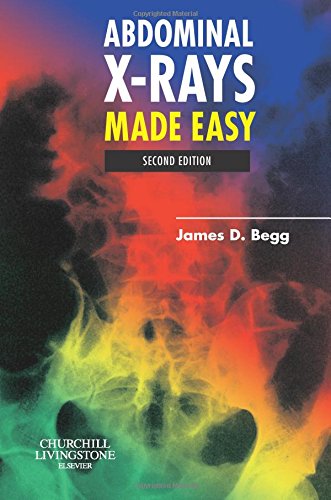 

general-books/general/abdominal-x-rays-made-easy-2-ed--9780443102578