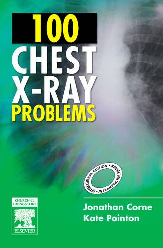 

clinical-sciences/radiology/100-chest-x-ray-problems-international-edition-1e-9780443103773
