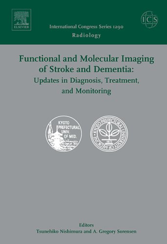 

exclusive-publishers/elsevier/functional-and-molecular-imaging-of-stroke-and-dementia-updates-in-diagnosis-treatment-and-monitoring--9780444521231
