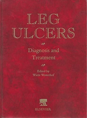 

exclusive-publishers/elsevier/leg-ulcers-diagnosis-and-treatment--9780444814272