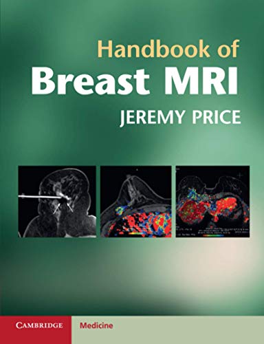 

mbbs/3-year/handbook-of-breast-mri-9780521139663