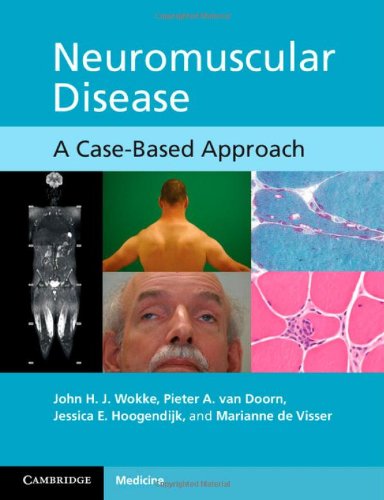 

general-books/general/neuromuscular-disease-a-case-based-approach--9780521171854