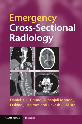

mbbs/4-year/emergency-cross-sectional-radiology-9780521279536