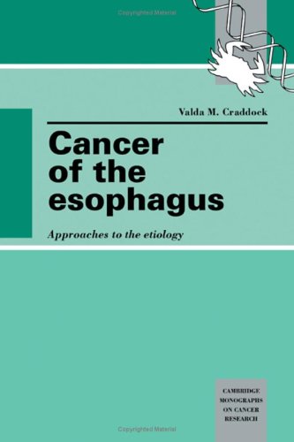 

special-offer/special-offer/cancer-of-the-esophagus-approaches-to-the-etiology--9780521373937