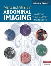 

exclusive-publishers/cambridge-university-press/pearls-and-pitfalls-in-abdominal-imaging--9780521513777