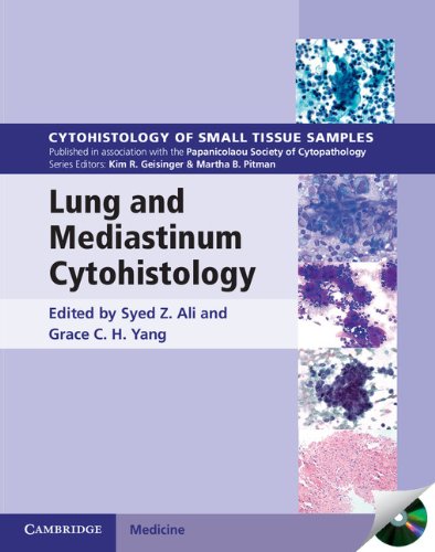 

exclusive-publishers/cambridge-university-press/lung-and-mediastinum-cytohistology--9780521516587