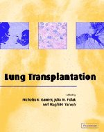 

clinical-sciences/respiratory-medicine/lung-transplantation-9780521651110