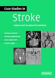 

exclusive-publishers/cambridge-university-press/case-studies-in-stroke--9780521673679
