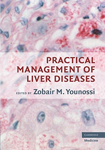 

exclusive-publishers/cambridge-university-press/practical-management-of-liver-diseases--9780521684897