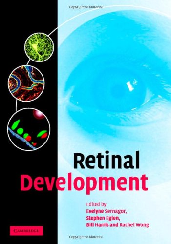 

general-books/general/retinal-development--9780521837989