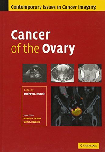 

mbbs/4-year/cancer-of-the-ovary-9780521863230