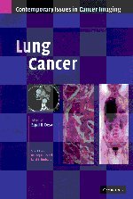 

surgical-sciences/oncology/lung-cancer-contemporary-issues-in-cancer-imaging--9780521872027
