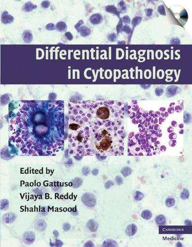 basic-sciences/pathology/differential-diagnosis-in-cytopathology-with-cd-rom-9780521873383