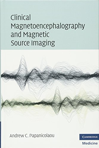 

clinical-sciences/psychology/clinical-magnetoencephalography-and-magnetic-source-imaging-9780521873758