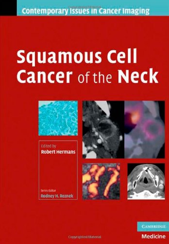 

mbbs/4-year/squamous-cell-cancer-of-the-neck-9780521886918