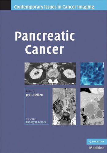 

surgical-sciences/oncology/heiken-pancreatic-cancer-9780521886925