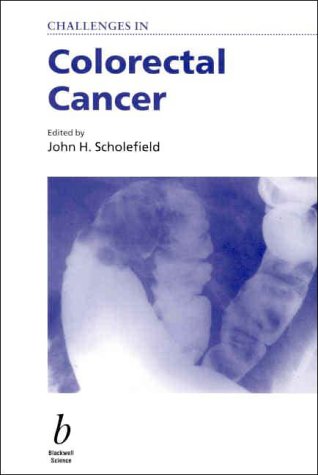 

general-books/general/challenges-in-colorectal-cancer--9780632051168