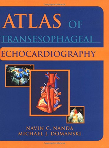 

general-books/general/atlas-of-transophageal-echocardiography--9780683063202