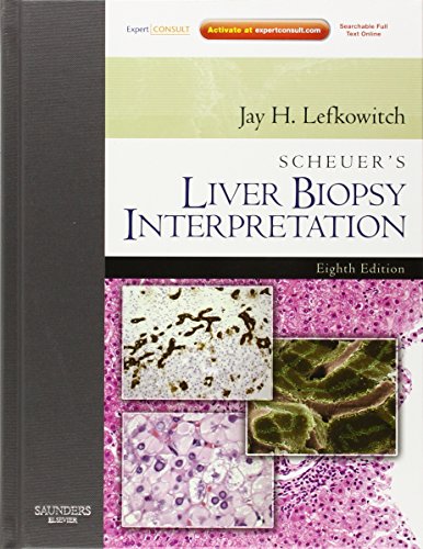 

basic-sciences/pathology/scheuer-s-liver-biopsy-interpretation-9780702034107