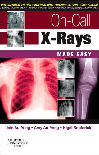 

general-books/general/on-call-x-rays-made-easy-international-edition--9780702034442