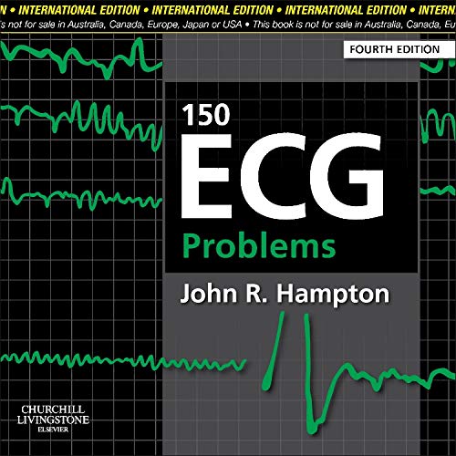 

clinical-sciences/cardiology/150-ecg-problems-international-edition-4e-9780702046711