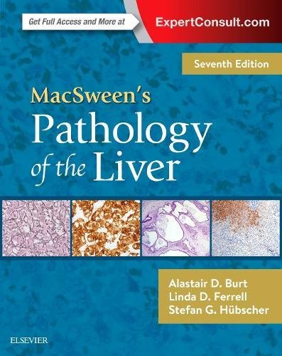 

exclusive-publishers/elsevier/macsween-s-pathology-of-the-liver-7edition-expert-consult--9780702066979