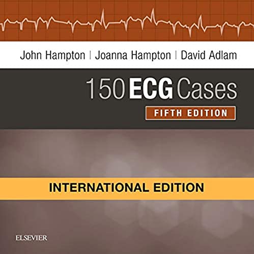 150 ECG CASES