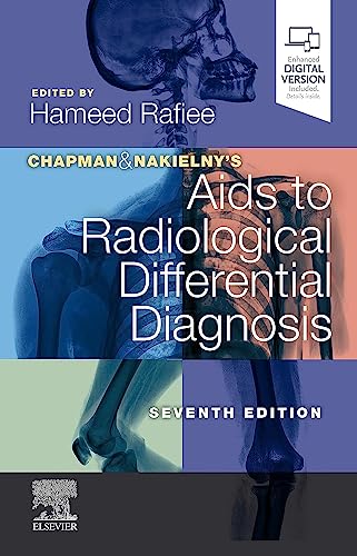 

exclusive-publishers/elsevier/chapman-nakielny-s-aids-to-radiological-differential-diagnosis-7ed--9780702075391
