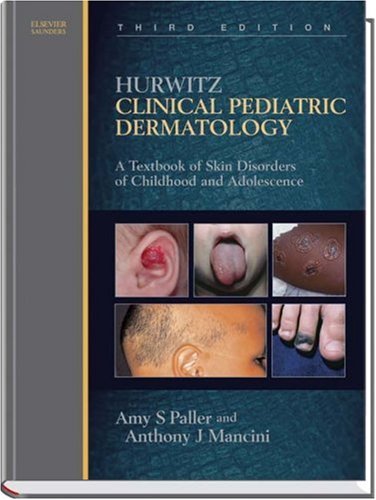 

exclusive-publishers/elsevier/hurwitz-clinical-pediatric-dermatology-3-ed--9780721604985