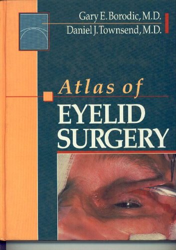 

general-books/general/-old-atlas-of-eyelid-surgery--9780721636405
