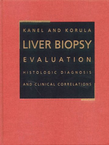 

exclusive-publishers/elsevier/liver-biopsy-evaluation-histologic-diagnosis-and-clinical-correlations--9780721676920