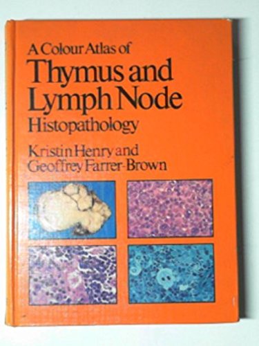 

exclusive-publishers/elsevier/a-colour-atlas-of-thymus-and-lymph-node-histopathology-with-ultrastructure--9780723407430