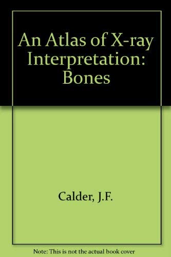 

exclusive-publishers/elsevier/an-atlas-of-radiological-interpretation-bones--9780723409533