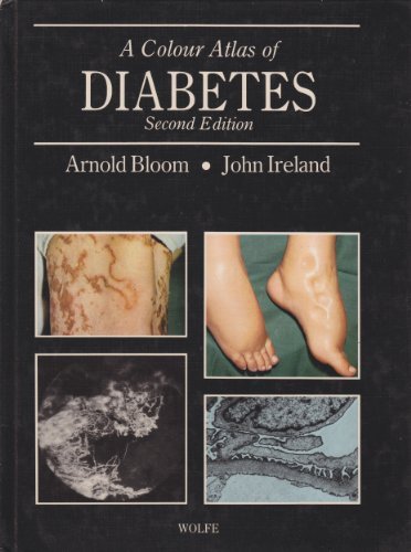 

general-books/general/a-colour-atlas-of-diabetes-2-ed--9780723409724
