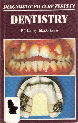 

dental-sciences/dentistry/diagnostic-picture-tests-in-dentistry-9780723409823
