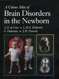 

exclusive-publishers/elsevier/a-colour-atlas-of-brain-disorders-in-the-newborn--9780723415121