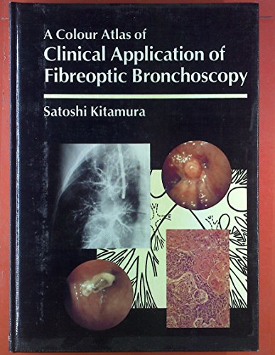 

clinical-sciences/respiratory-medicine/a-colour-atlas-of-clinical-application-of-fiberoptic-bronchoscopy-9780723415855
