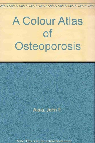 

general-books/general/a-colour-atlas-of-osteoporosis--9780723416913