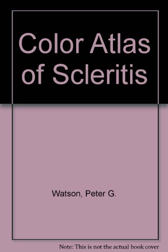 

general-books/general/colour-atlas-of-scleritis-9780723417538
